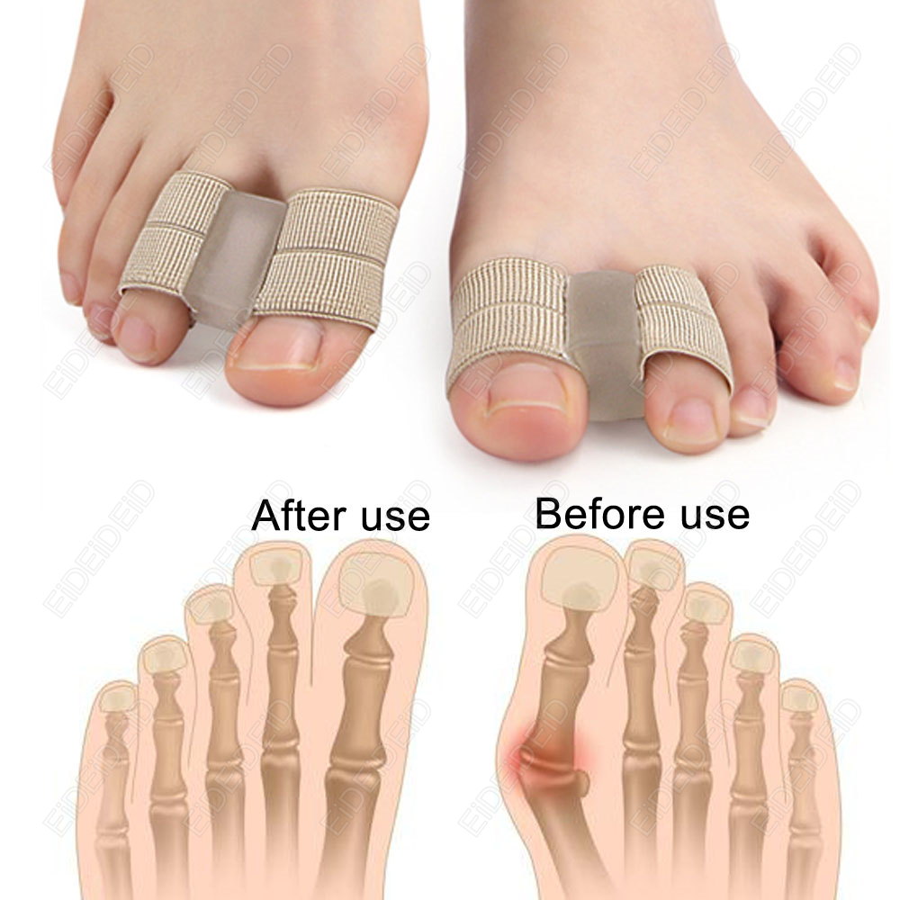 Корректор бурсита стопы, ортоп – обзор и цена Women'S Shoes With Bunions